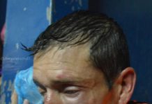 Salvaje agresión a un árbitro en el torneo Federal B: «No puedo ni levantar los labios»