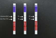 Portátil, rápido y de bajo costo: cómo funciona el test nacional que detecta el dengue
