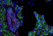 Detectan otra variante del coronavirus en Estados Unidos que podría ser más resistente