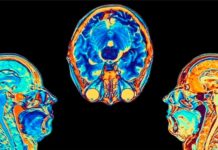 Covid: el estudio que muestra cómo cambia el cerebro tras una infección por coronavirus, aunque esta sea leve