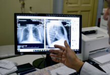 Humo en el ambiente: afecciones respiratorias y cómo evitar complicaciones